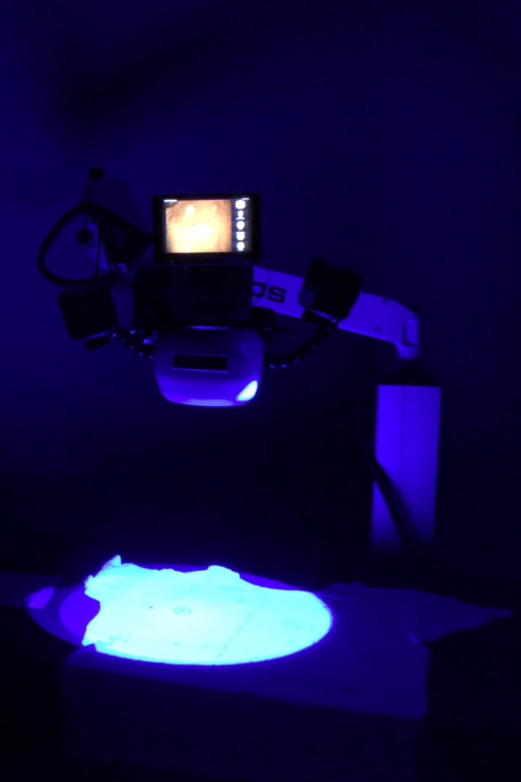 LSV2 Fluorescence screening